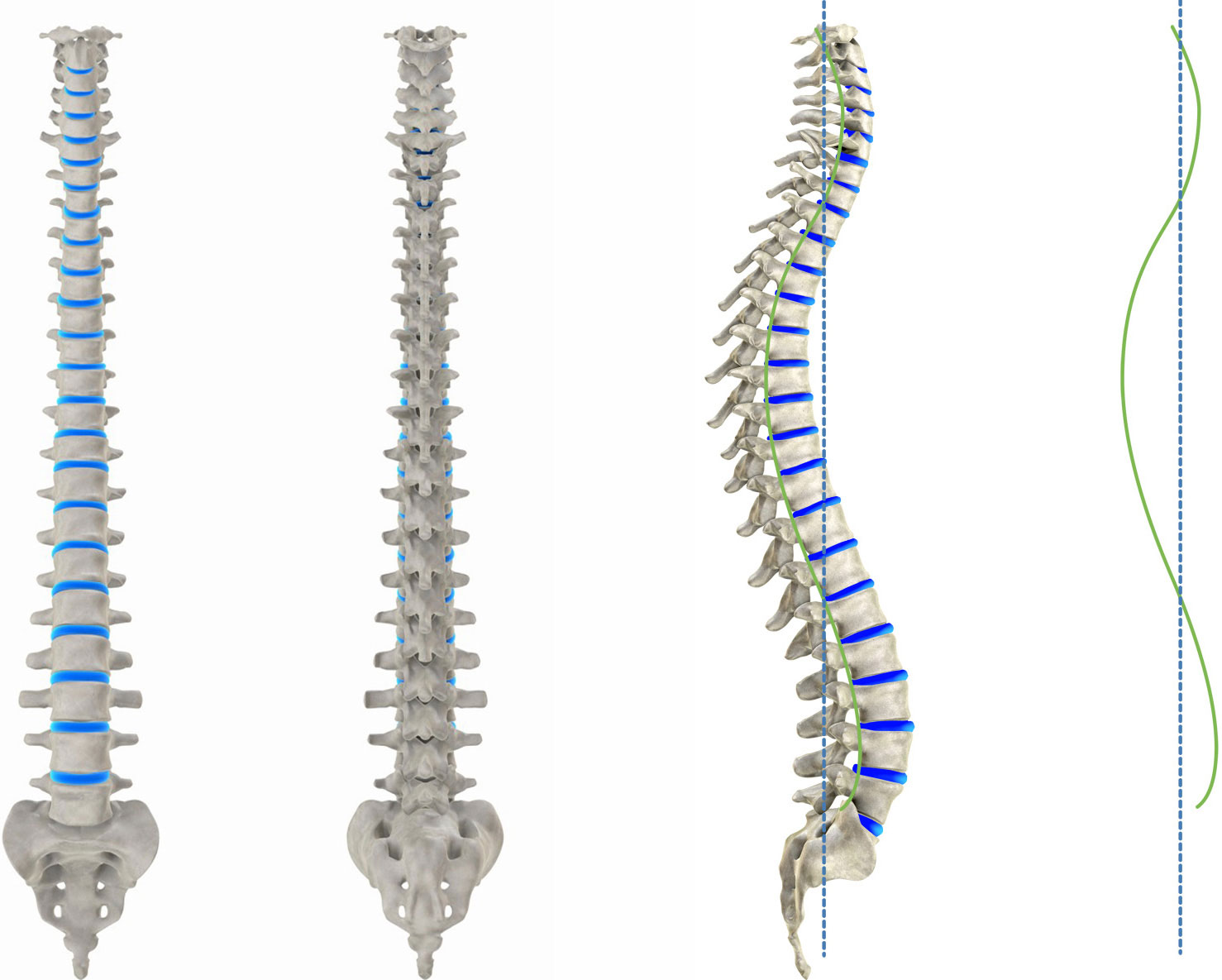 The Ideal Spinal Column