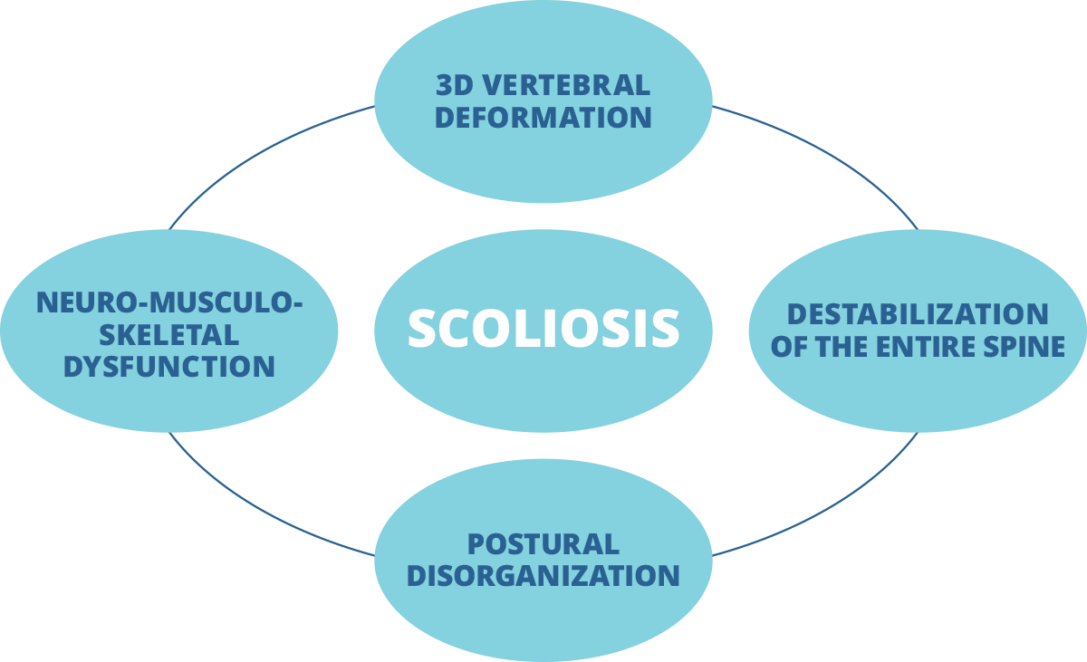 Scoliosis [image]