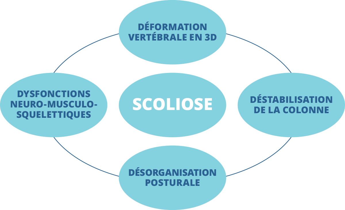 Scoliosis